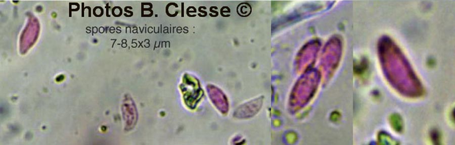 Botryobasidium subcoronatum