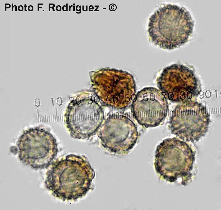 Gymnomyces mistiformis