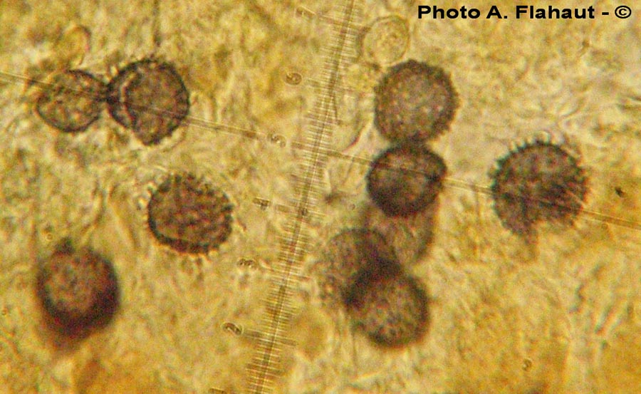 Gymnomyces xanthosporus