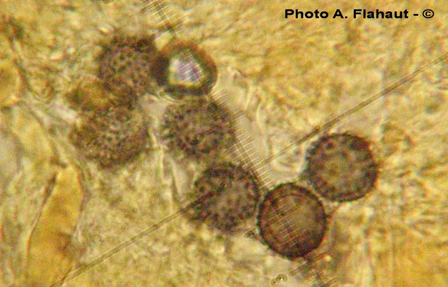 Gymnomyces xanthosporus