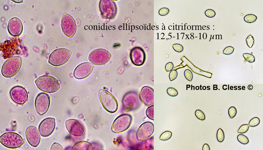 Haplotrichum capitatum (Botryobasidium candicans)