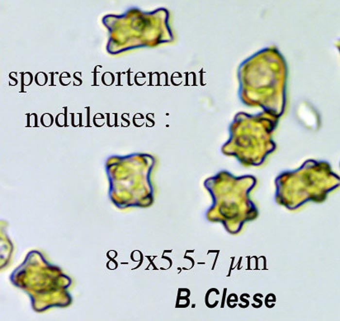 Inocybe margaritispora