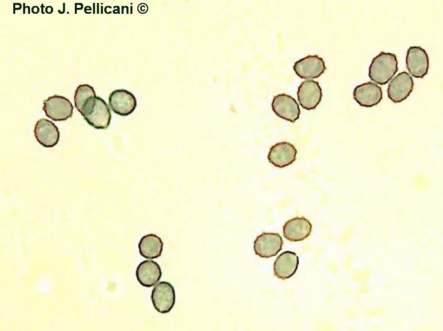 Leucopaxillus paradoxus