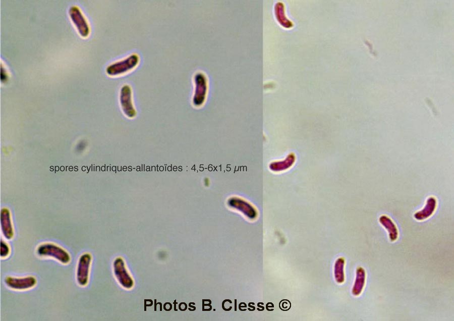 Odonticium septocystidia