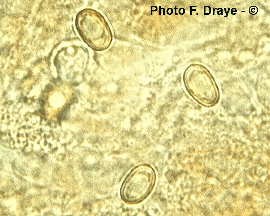 Paxillus filamentosus