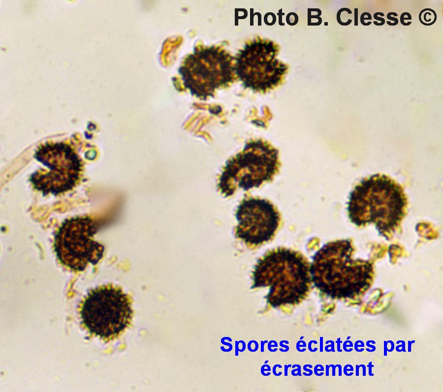 Scleroderma aerolatum