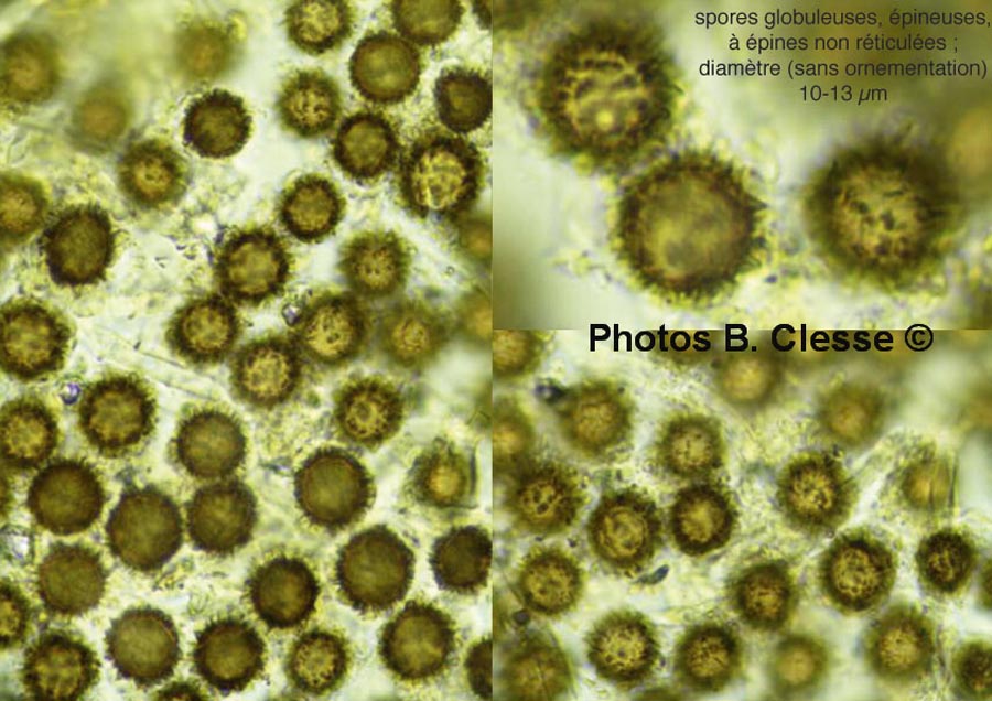 Scleroderma areolatum