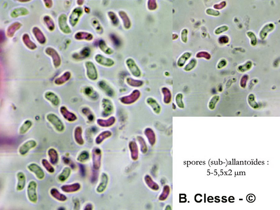 Sistotrema brinkmannii