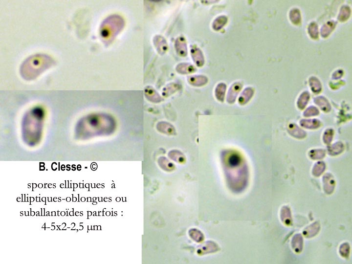 Sistotrema brinkmannii