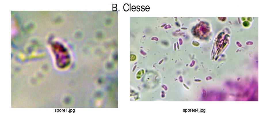 Sistotrema porulosum