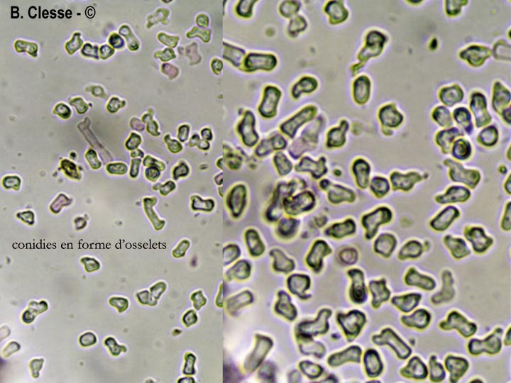 Trechispora stevensonii