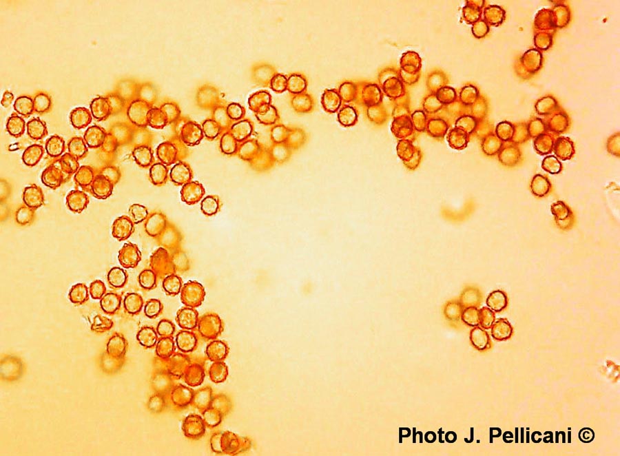 Tulostoma squamosum