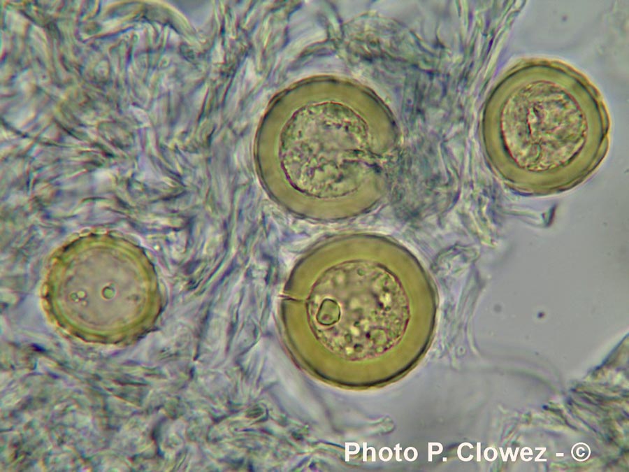 Glomus microcarpum