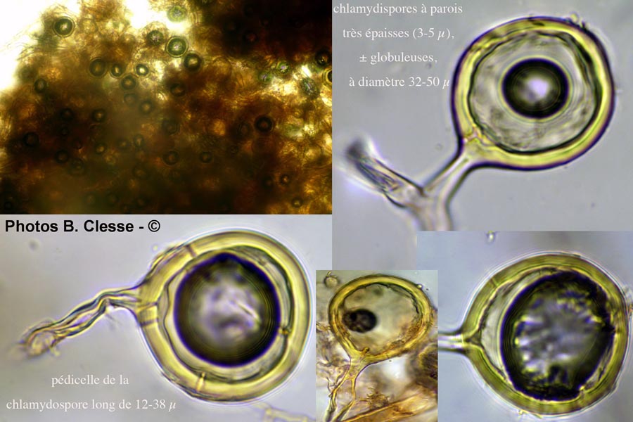 Glomus sp. sur Tilia sp. (tilleul)