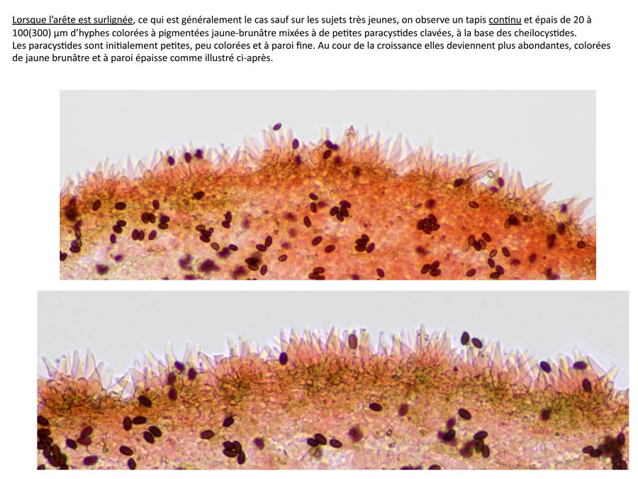 Psathyrella microrrhiza