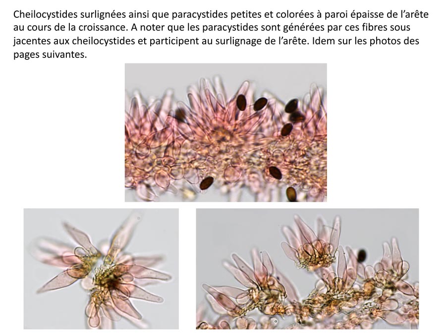 Psathyrella microrrhiza