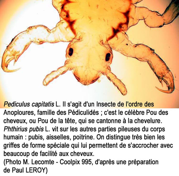 Pediculus capitis