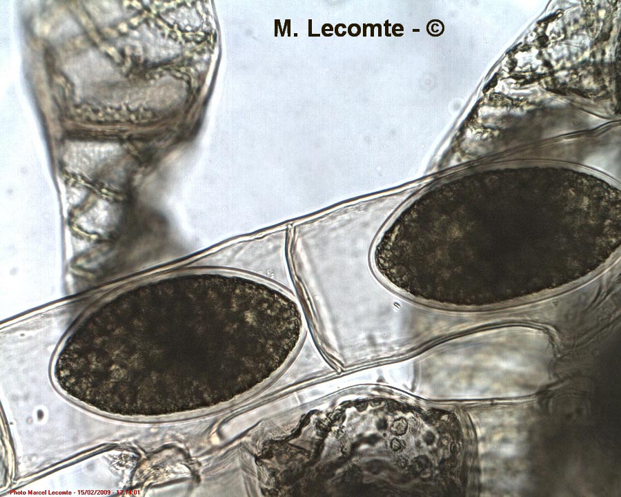 Spirogyra sp.