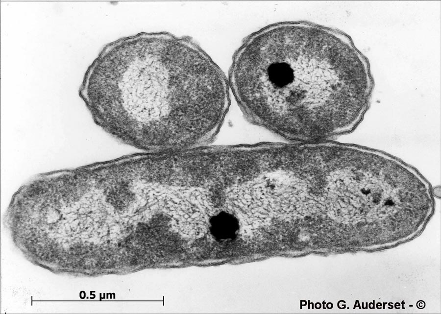 Pseudomonas fluorescens