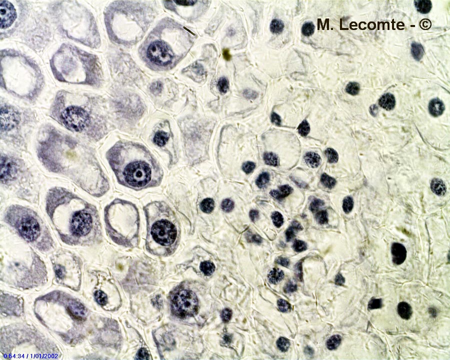 Rhizobium meliloti