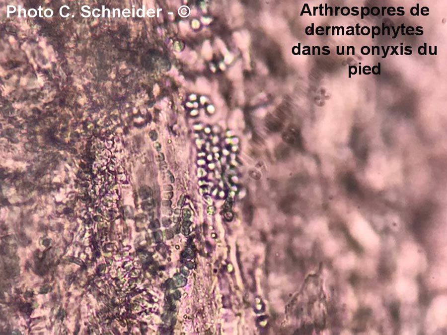 Arthrospores dermatophytes