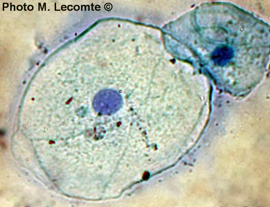 Cellules épithéliales