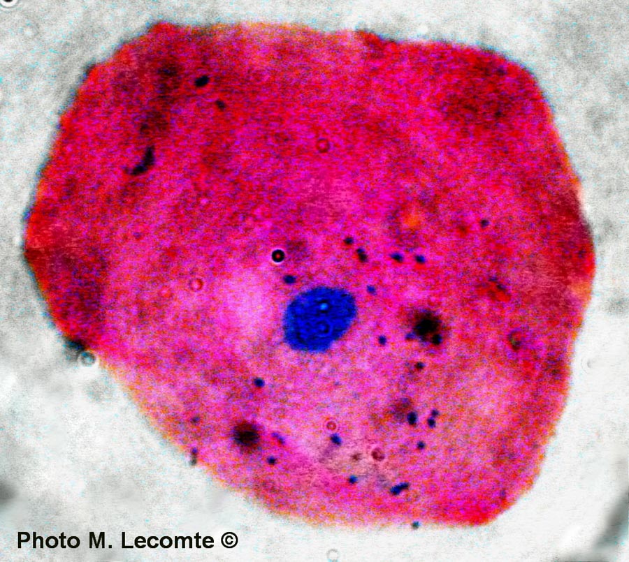 Cellules épithéliales de la bouche (M. Lecomte)