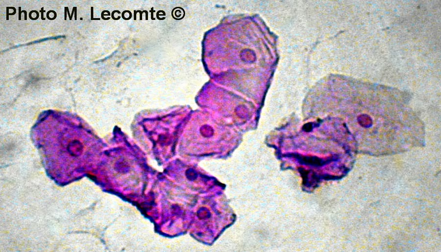 Cellules épithéliales