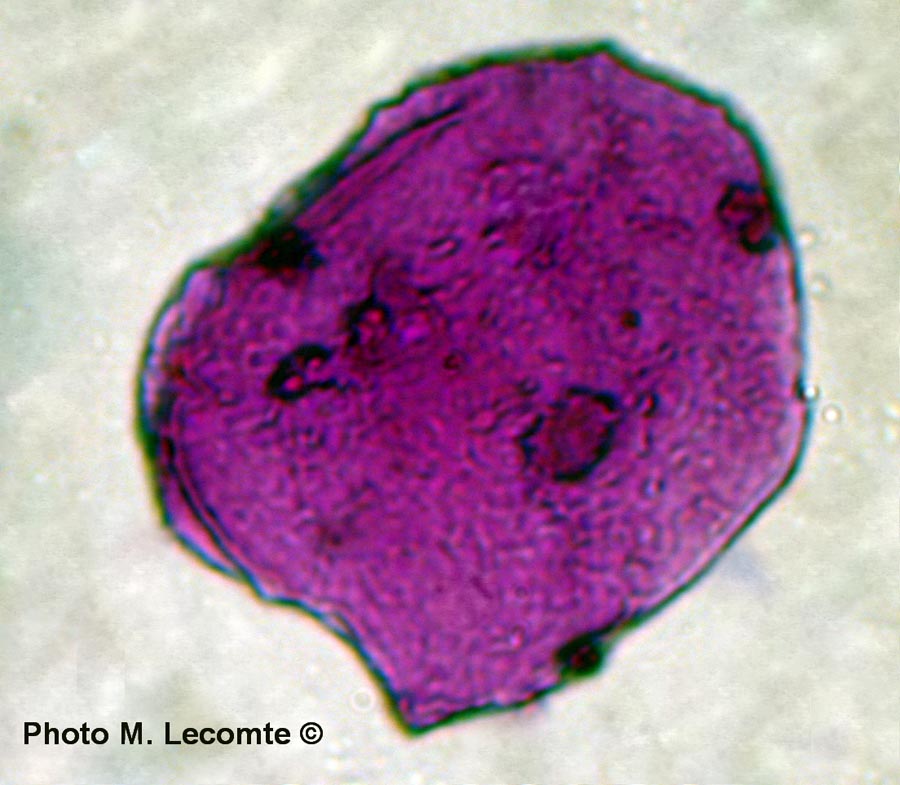 Cellules épithéliales