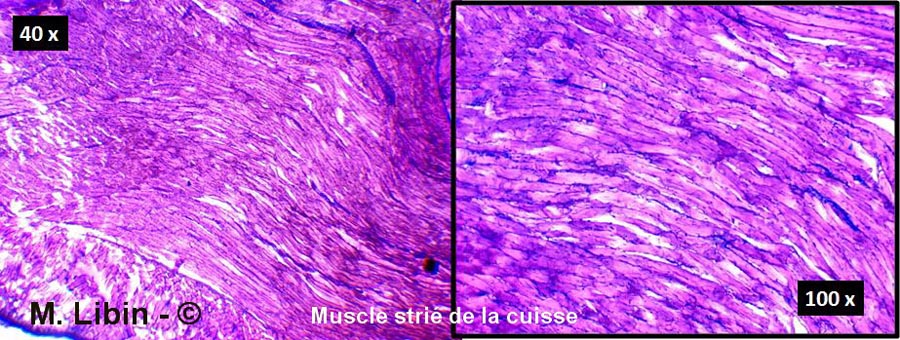 Muscle strié de la cuisse