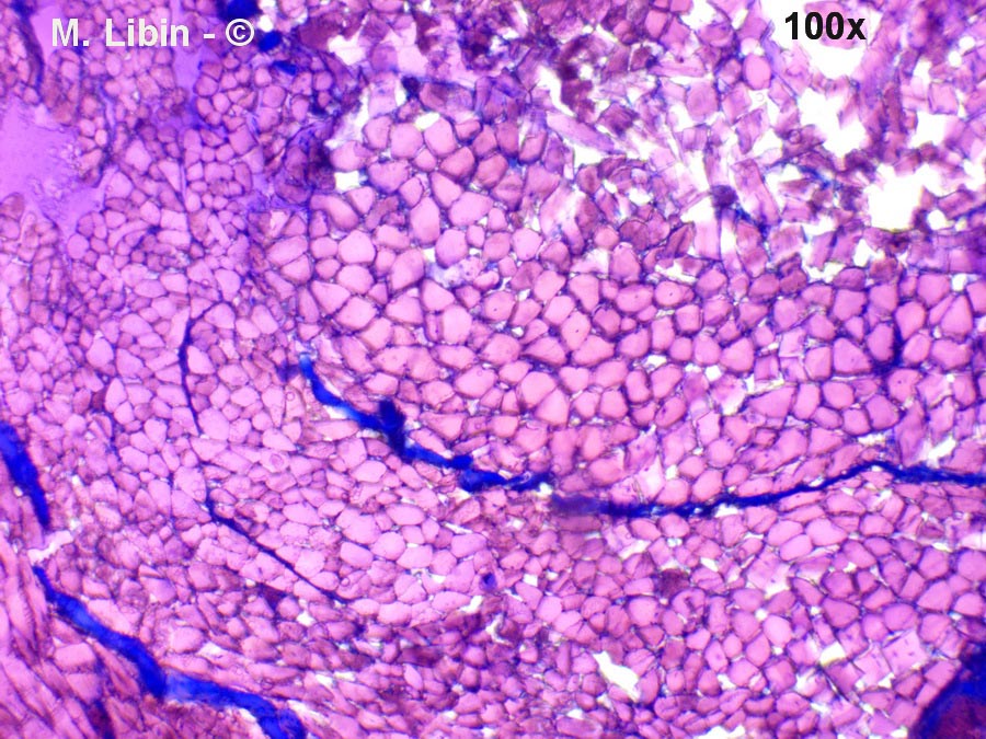 Muscle strié patte postérieure