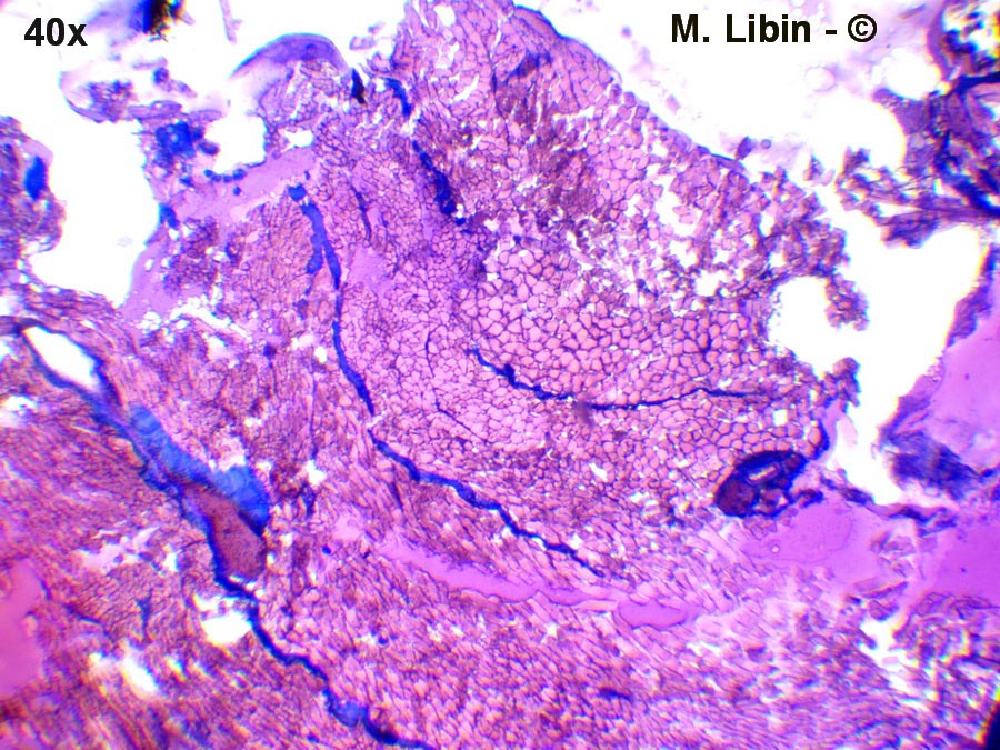 Muscle strié patte postérieure