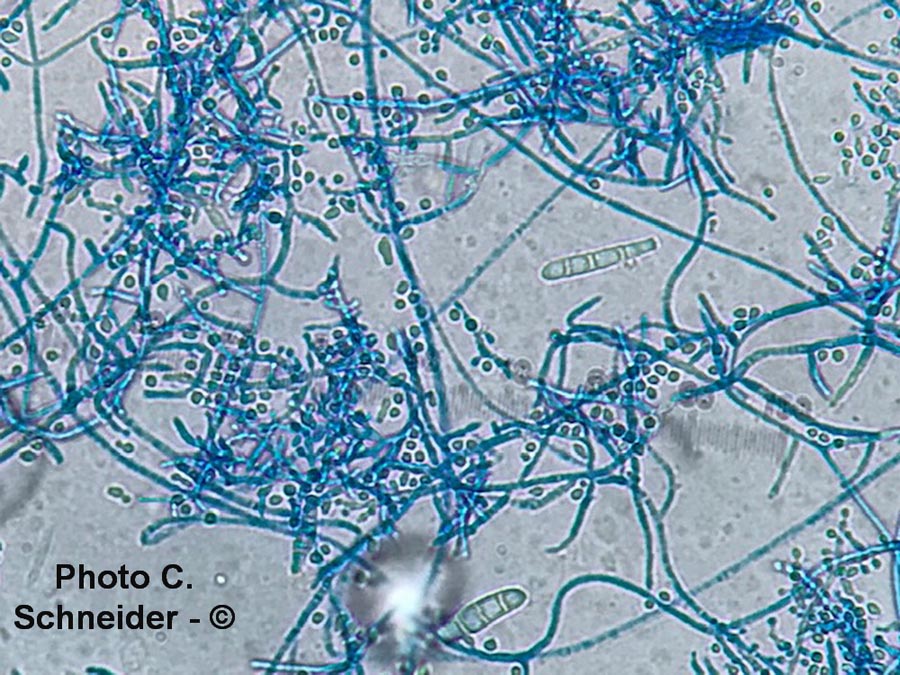 Trichophyton mentagrophytes