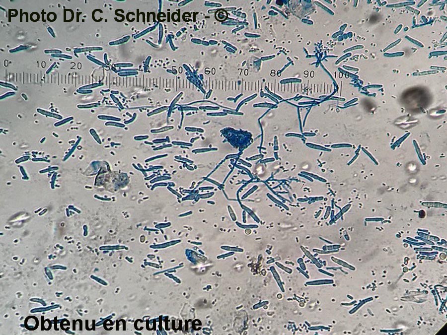 Trichophyton mentagrophytes