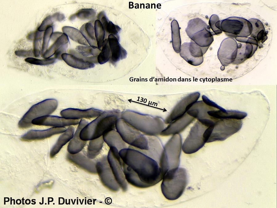 Grains d’amidon dans une banane