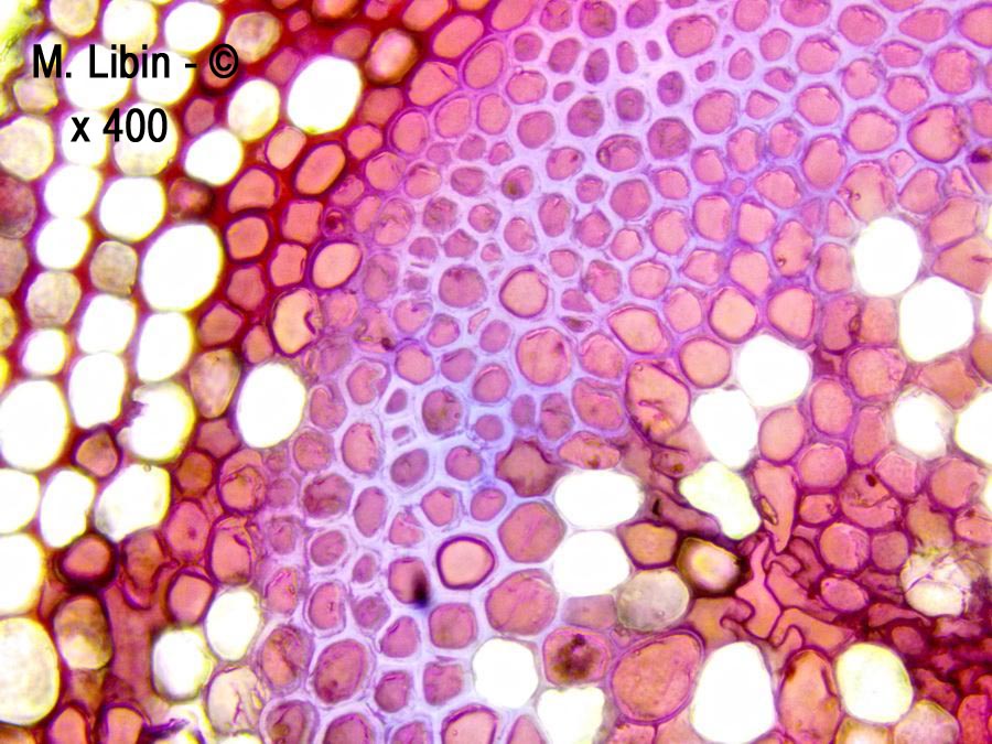 Bryone (Bryonia sp.) (coupes transversales dans la tige)