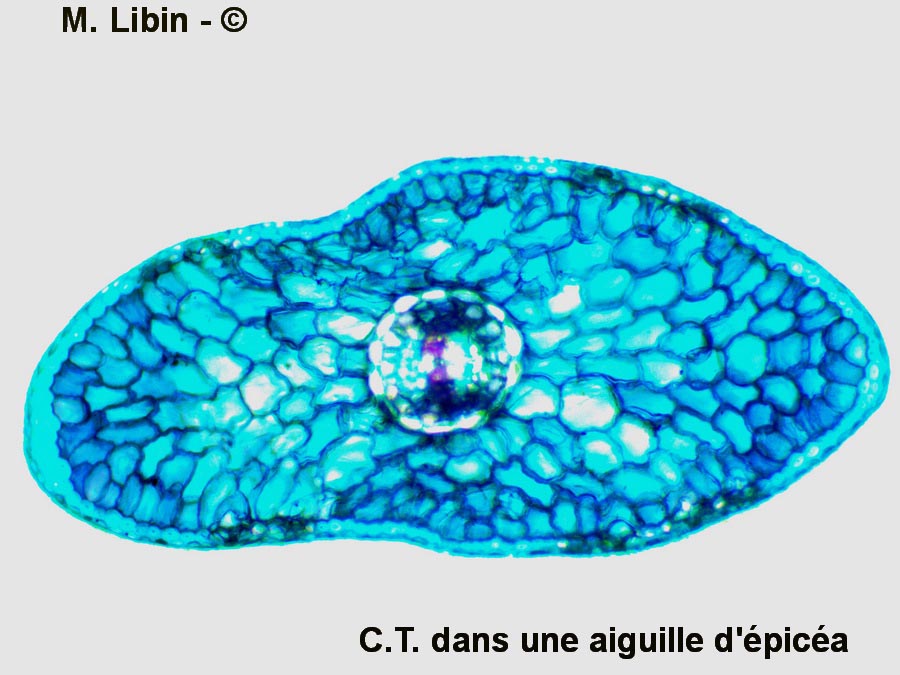 Epicéa (Picea abies) (coupe dans l'aiguille)