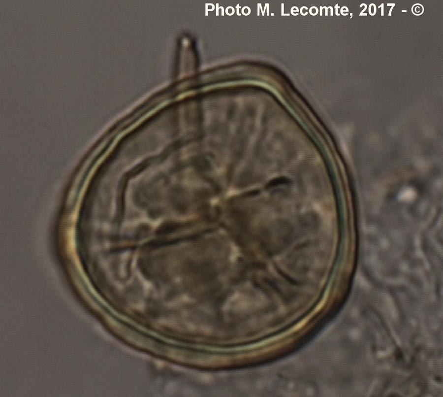 Spores de Lycophytes (M. Lecomte)