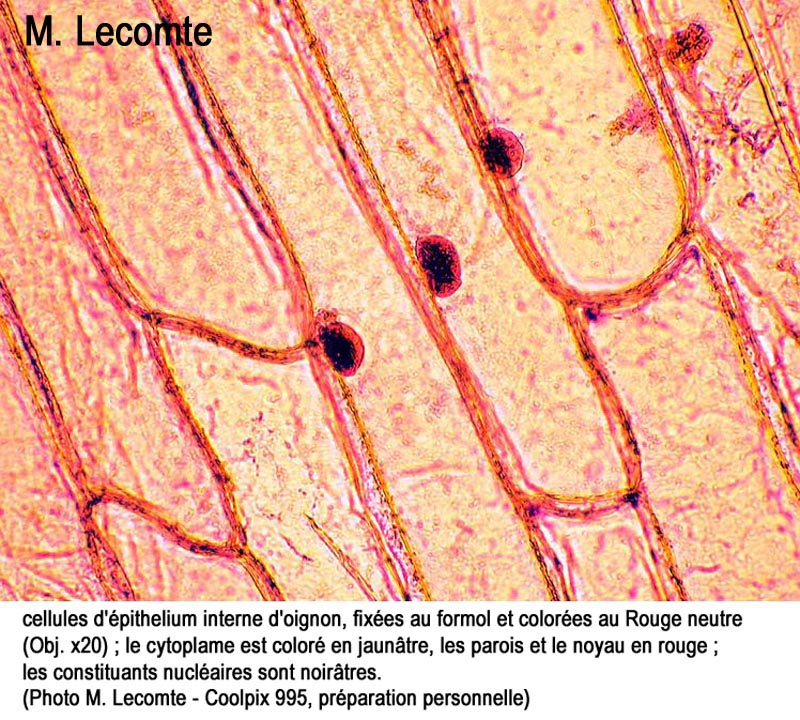 Oignon : cellules