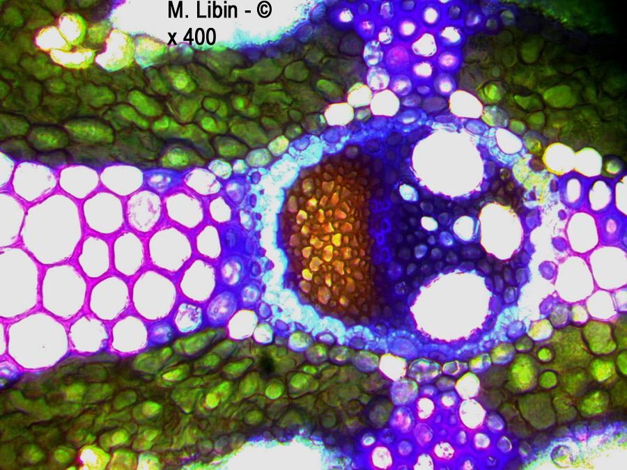 Oyat (Ammophila sp.) (coupes transversales dans la tige)