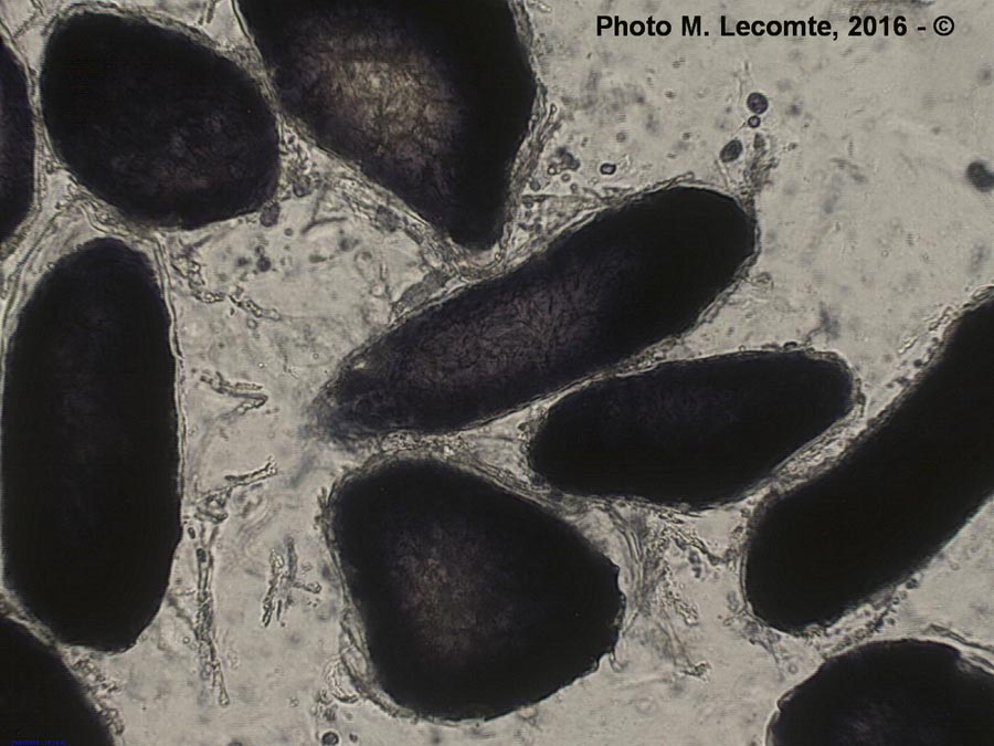 Grains d’amidon dans un pois chiche (Cicer arietinum)