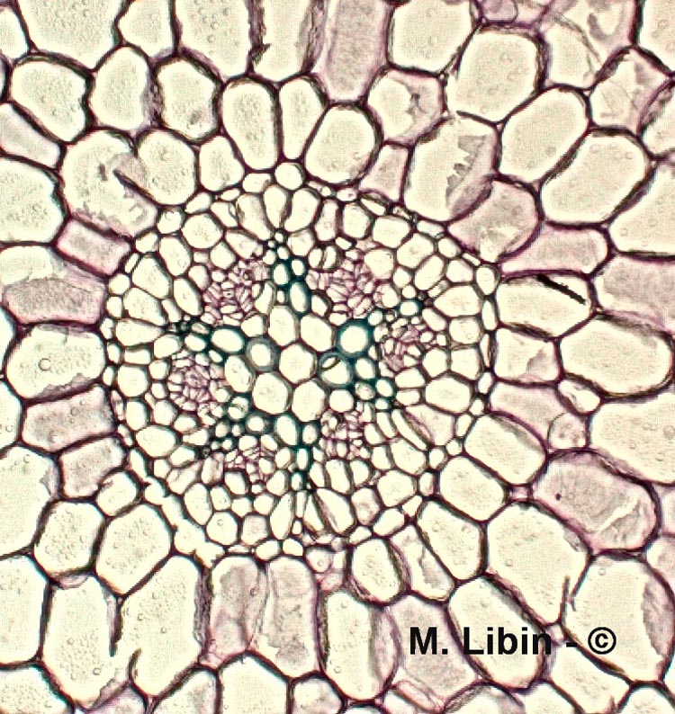 Ranunculus ficaria (ficaire, coupe dans une racine)