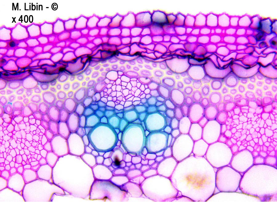 Renouée bistorte (Bistorta officinalis) (coupes transversales dans une tige)