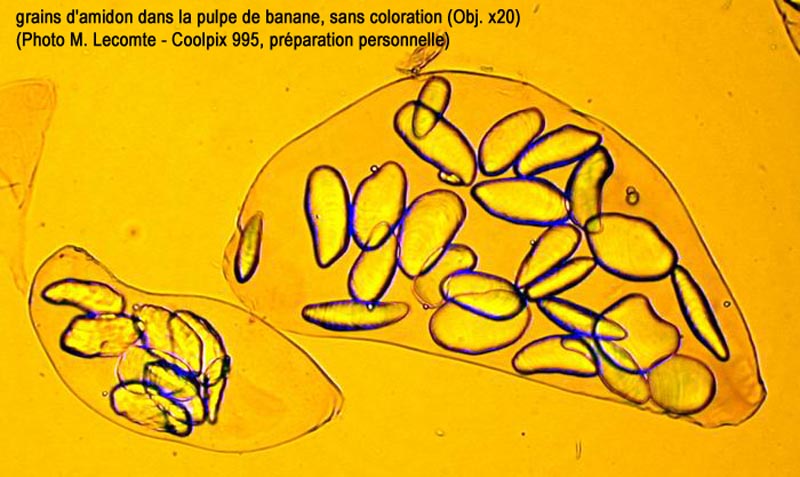 Grains d’amidon dans une banane