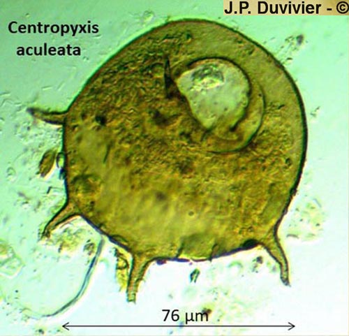 Centropyxis aculeata