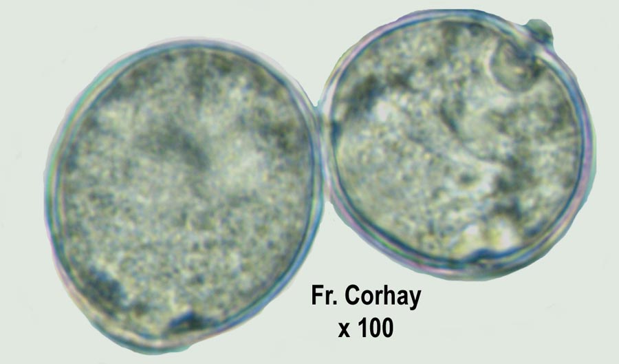 Robinia pseudoacacia (robinier faux-acacia)