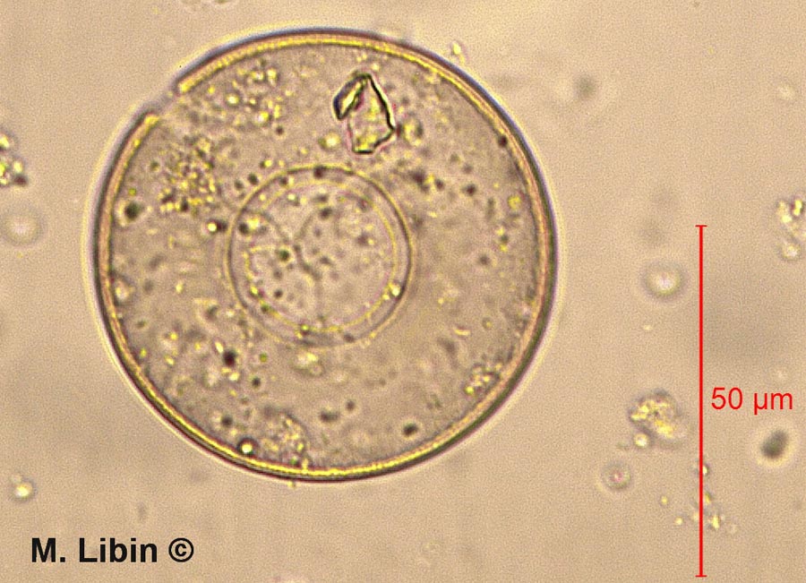 Arcella arenaria