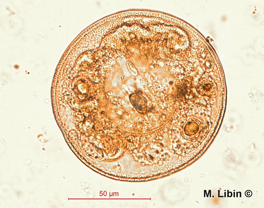 Arcella gibbosa