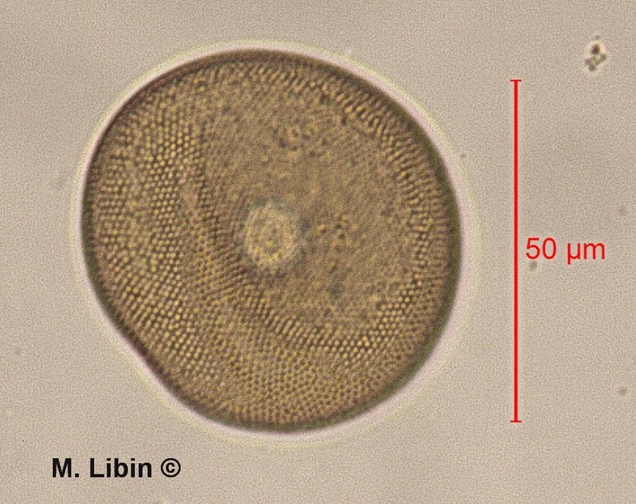 Arcella hemispherica
