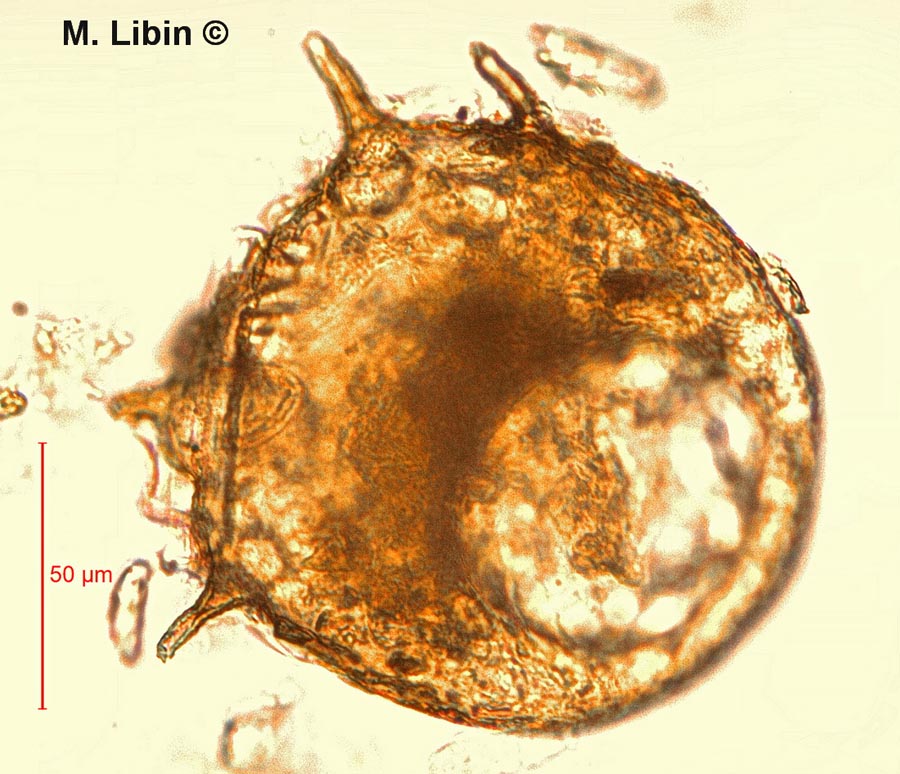 Centropyxis aculeata